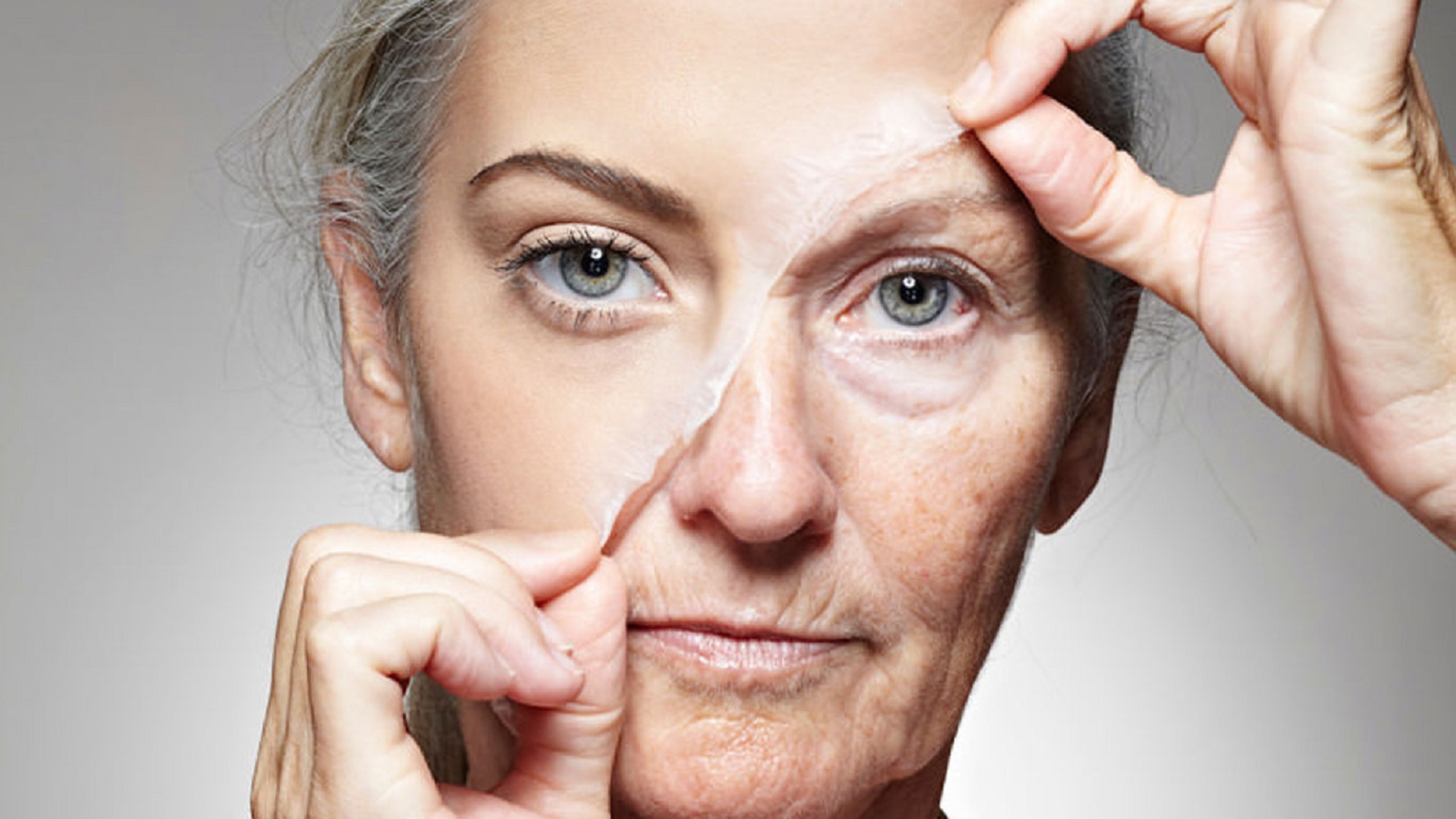 A ráncok kialakulása, anti-aging kezelések